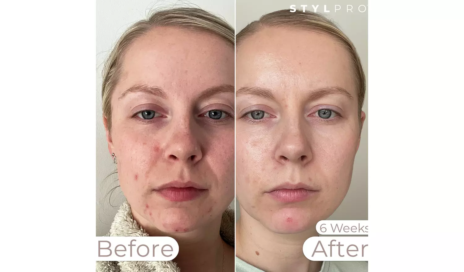 Stylpro Weavelength LED Face Mask