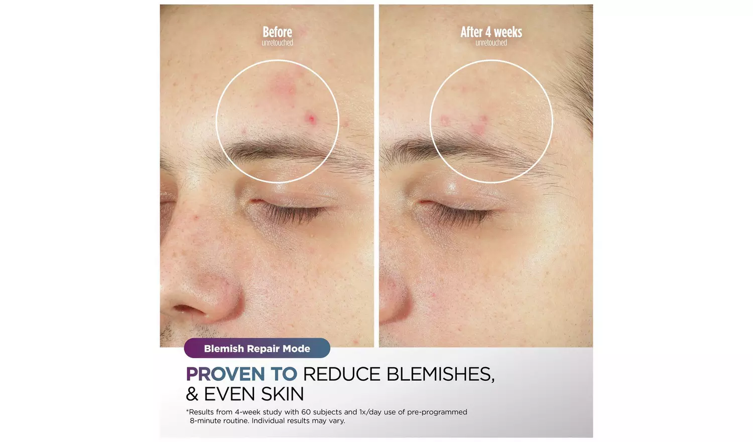 Shark CryoGlow Under-Eye Cooling LED Face Mask - Lilac