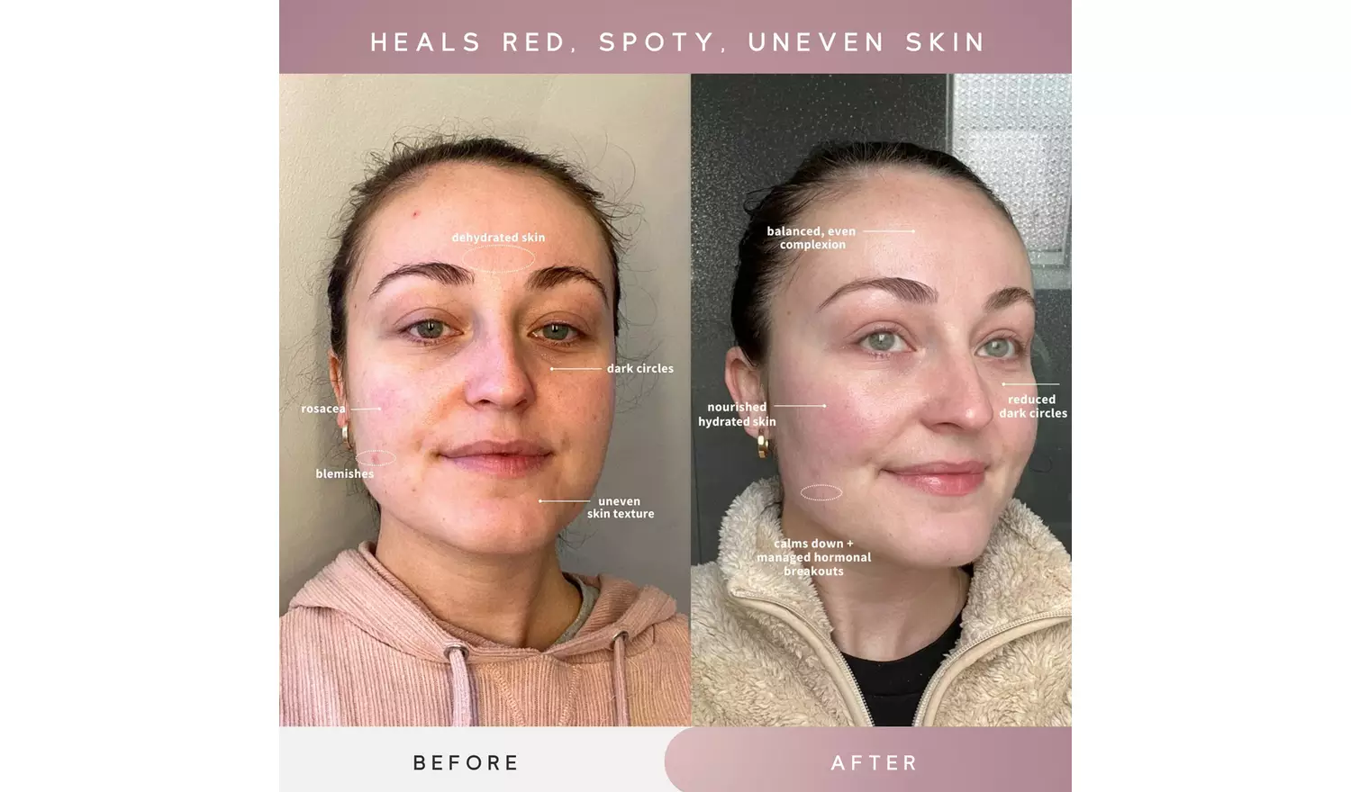 Sensse Professional LED Light Therapy Facial Mask