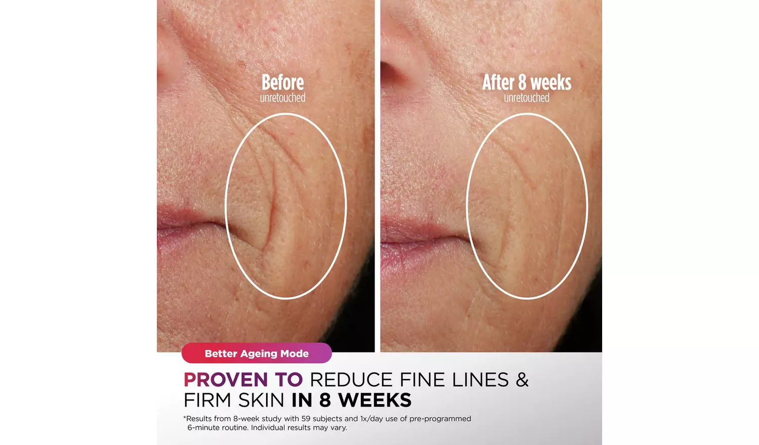 Shark CryoGlow Under-Eye Cooling LED Face Mask – Blue