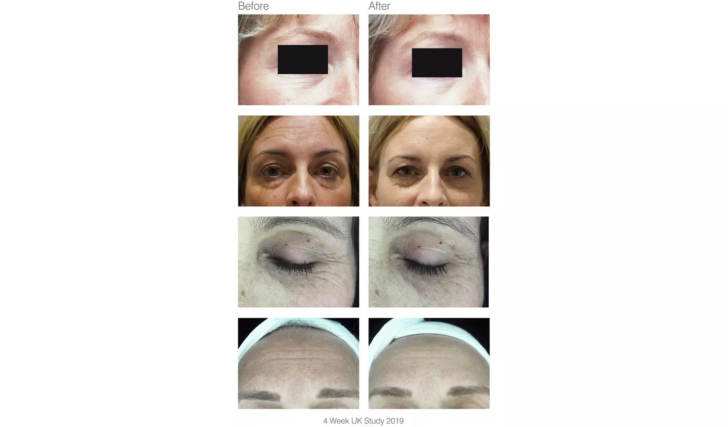 Rio Facelite Red Light LED Face Mask