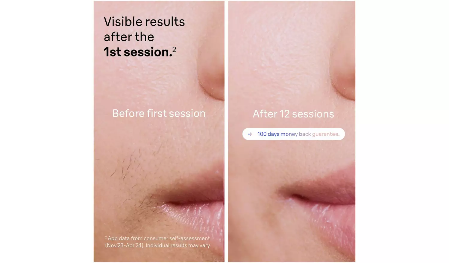 Braun Skin i-expert PL7387 Corded IPL Hair Removal