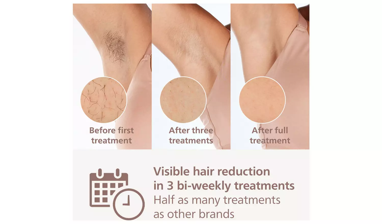 Philips Lumea Series 8000 BRI947/00 Corded IPL Hair Removal